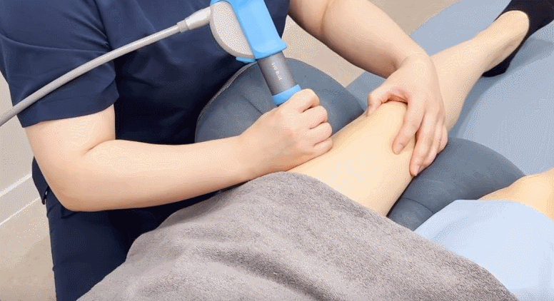 종아리와 하체 주변에 체외충격파를 적용하는 치료 장면